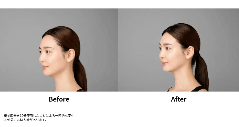 Brighteのems美顔器、ELEKIBRUSH+を利用した際のBefore、After画像