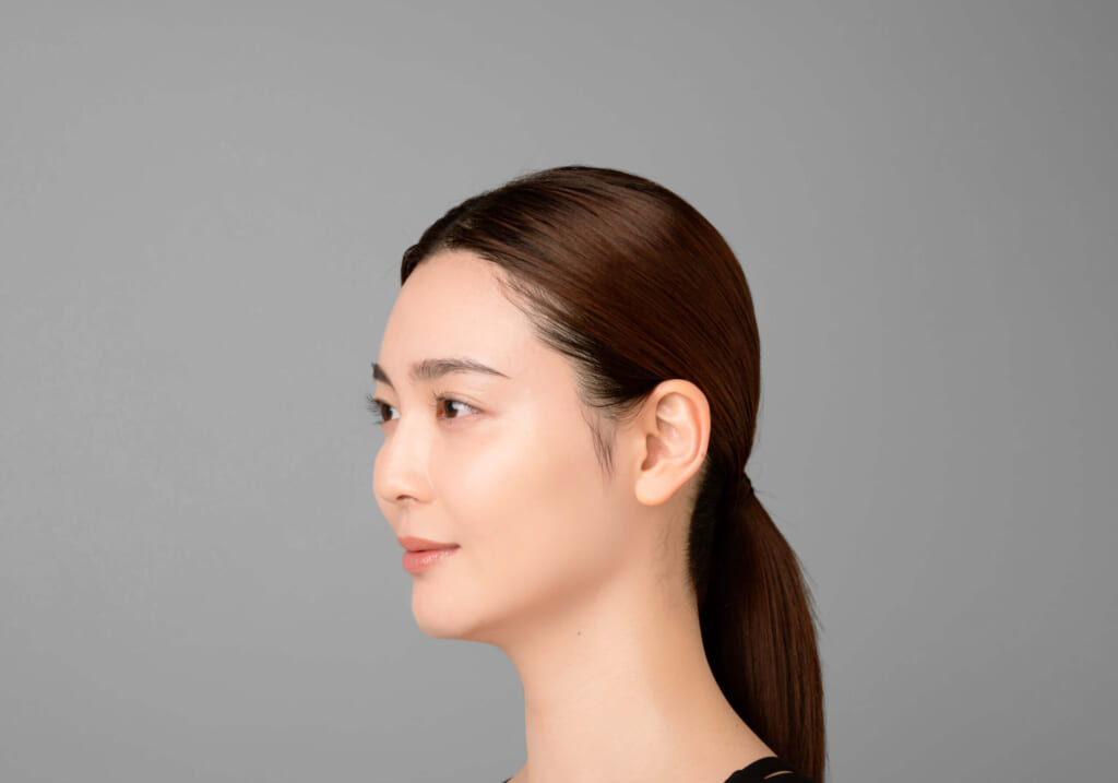ELEKI BRUSH+を使用した人のBefore画像