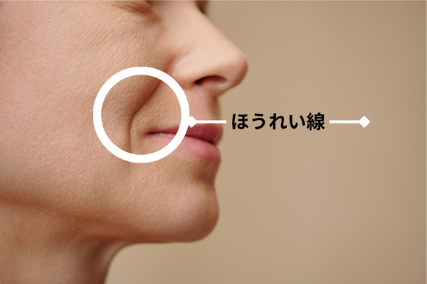 ほうれい線とは？