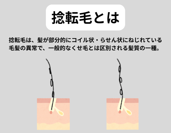 捻転毛のイメージ画像