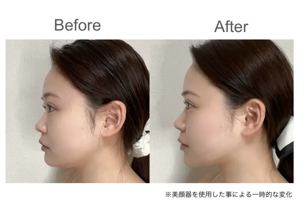 使用後にフェイスラインがスッとした・むくみが抜けることが分かる画像