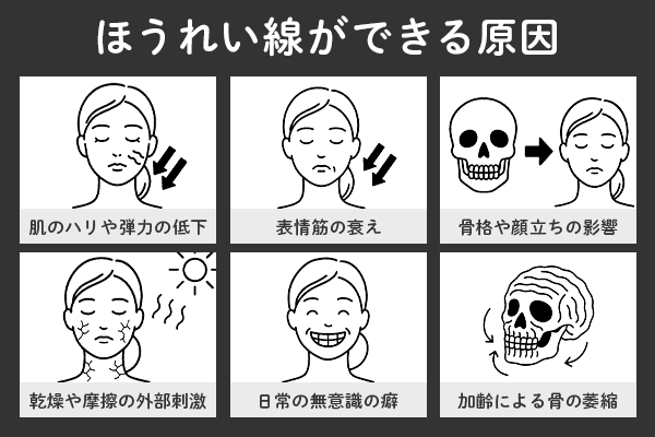 ほうれい線ができる原因