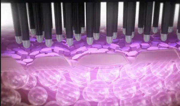 EMS・LEDなど美容機能が豊富か