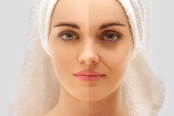 エイジングケアとは