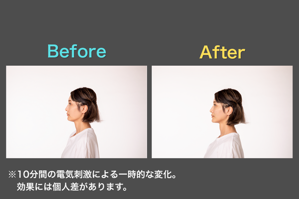 ELEKI BRUSH+(エレキブラシ)使用後のBefore・After
