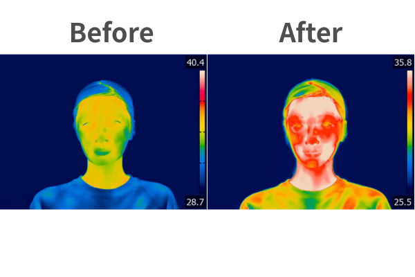 エレキブラシを10分使用した後のBefore After画像