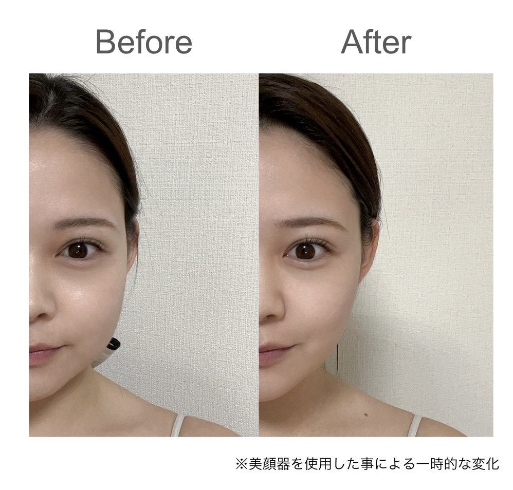 Brighte】エレキリフトの口コミ・評判を調査！効果や使い方を解説